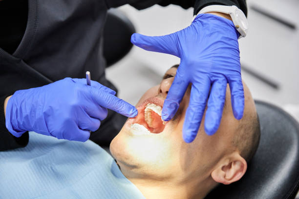Best Emergency Treatment for Dental Infections or Abscesses in Hawley, MN